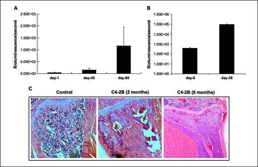 Fig. 6. A, growth kinetics of osteoblastic C4-2B cells in the tibia of SCID mice. B, growth kinetics of PC3 cells in the tibia of SCID mice. C, C4-2B–injected tibia showing osteolytic lesions when allowed to grow for 6 mo.
