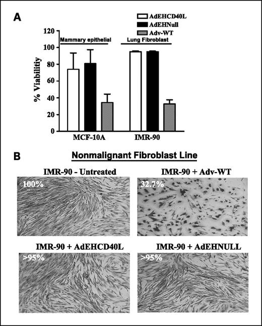 Fig. 2. AdEHCD40L cytotoxic activity in nonmalignant cells. A, cytotoxicity to nonmalignant cells. Cytotoxic activity of AdEHCD40L, AdEHNull, and Adv-WT (MOI = 1 pfu/cell) was determined in normal mammary epithelial (MCF-10A) and normal lung fibroblast (IMR-90) lines by the trypan blue dye exclusion assay. Columns, mean (n = 3); bars, SD. B, viral cytopathic effects by light microscopy. Viral cytopathic effects of AdEHCD40L, AdEHNull, and Adv-WT (MOI = 1 pfu/cell) infected IMR-90 lung fibroblast cells were examined by light microscopy following crystal violet staining. Values are mean of two separate experiments, each done in triplicates with a variance of <10%. Magnification, ×200.
