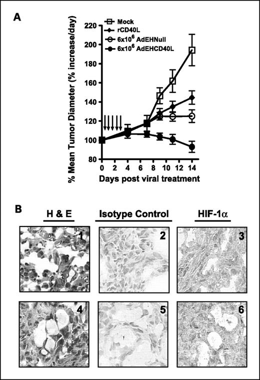 Fig. 3. Antitumor activity of AdEHCD40L in vivo. MDA-MB-231 tumor xenografts were established in SCID mice by s.c. injection of 3 × 106 cells. Five daily injections of AdEHCD40L (•), AdEHNull (○) [both at 6 × 106 pfu], recombinant CD40L protein (⧫; 1 μg/mL), or PBS (□) were given intratumorally when the tumor xenograft reached a size of >4 mm in diameter. A, mean percent increase in tumor diameter after treatment. The percent increase for each animal was determined by comparison with its tumor diameter before treatment. Points, mean (n = 10); bars, SE. B, HIF-1α expression in MDA-MB-231 xenografts. Representative expression profile is for a mock-treated tumor xenograft (1, 2, and 3) and an AdEHCD40L-treated xenograft (4, 5, and 6) after incubation with an isotypic control primary antibody (2 and 5) or an HIF-1α primary antibody (3 and 6) and parallel immunohistochemical processing. The H&E-treated biopsy is also shown (1 and 4, respectively). Magnification, ×400.