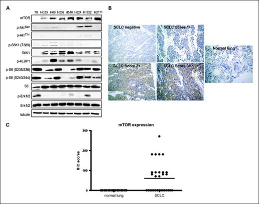 Fig. 1. Expression of mTOR and downstream signaling molecules in human SCLC cell lines and patient samples. A, equal amounts of lysates from purified human type II lung epithelial cells (TII), or human SCLC cell lines, as indicated, were analyzed by SDS-PAGE and Western blotting with antibodies specific for the proteins indicated. B, immunostaining with mTOR showing negative SCLC staining and representative mTOR SCLC positive staining, compared with normal lung tissue. C, the mean immunohistochemical staining scores of mTOR in 30 paraffin-embedded specimens each of normal lung tissues and of 30 SCLC paraffin-embedded specimens. Immunohistochemical scores = percentage of positive cells × staining intensity (for details, see Materials and Methods).