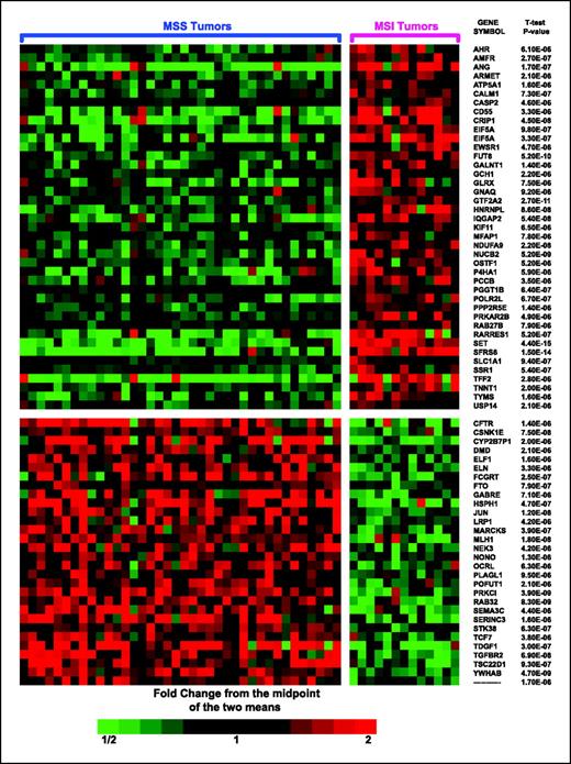 Fig. 1. Differentially expressed genes in MSI-H and MSS tumors from the MECC study. Tumors exhibiting the MSI-L phenotype were excluded. Each column corresponds to a separate sample and grouped by microsatellite status. Each row represents a probe set with P < 0.00001 (false discovery rate < 0.1%) whose expression is color-coded according to the indicated scale and displayed in alphabetical order. Gene symbols of HuGeneFL probe sets and its corresponding P values (right). Note that general transcription factor IIA (GTF2A2), eukaryotic translation initiation factor 5a (EIF5A), splicing factor arginine/serine-rich 6 (SFRS6), thymidylate synthetase (TYMS), a member of ras oncogene family Rab27b (RAB27B), and protein kinase cyclic AMP-dependent type II (prkar2b) showed overexpression in MSI-H cancers. On the other hand, protein kinase C (PRKCI), mutL homologue 1 (MLH1), and transforming growth factor-β receptor II (TGFBR2) showed lower expression in MSI-H cancers. A complete list with HuGeneFL probe set ID, gene symbol, and gene title is presented in Supplementary Table S2.