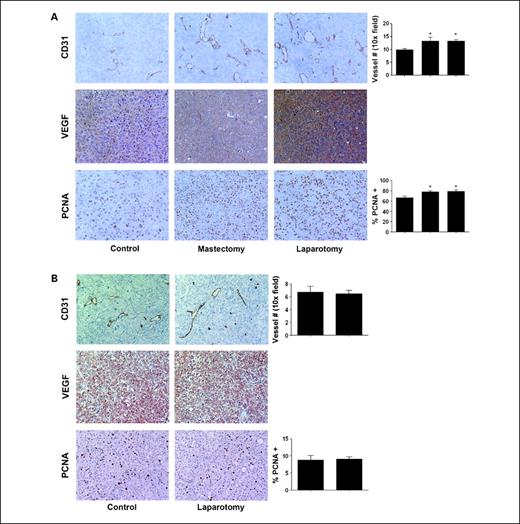 Fig. 3. Proliferation and angiogenesis in tumor tissues is increased in tumors harvested from animals exposed to surgical stress. A, HeyA8 tumor samples from control (anesthesia alone) or surgically (mastectomy or laparotomy) stressed animals were stained for CD31, VEGF, and PCNA by immunohistochemistry. B, RMG-II (ADRB null) tumor samples from mice exposed to surgery did not show any differences in CD31, VEGF, and PCNA staining between control and laparotomy. All photographs were taken at original magnification ×100. The bars in the graphs correspond sequentially to the labeled columns of images at left. Bars, SE. *, P < 0.05.