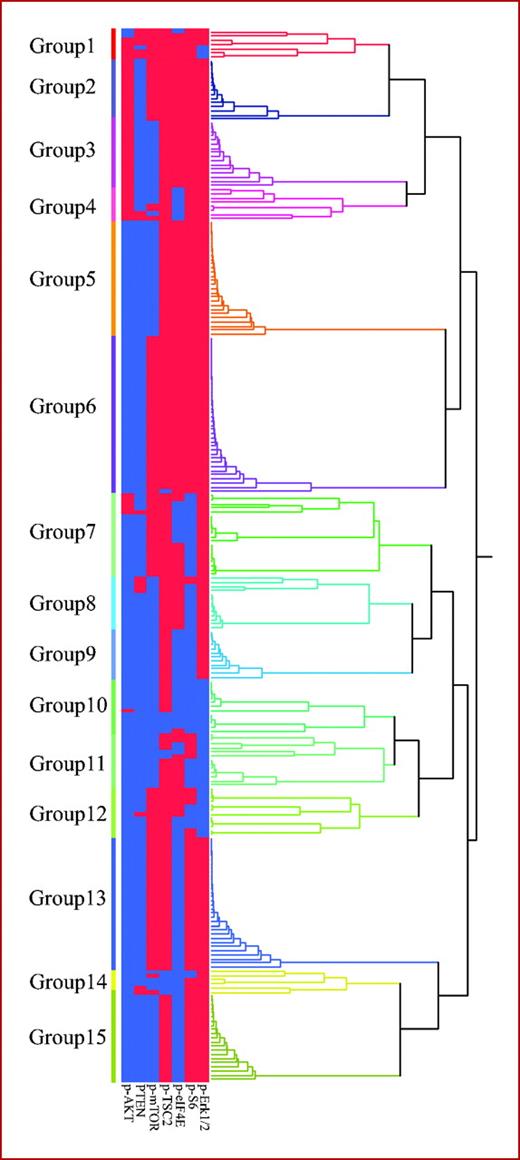 Fig. 3. Hierarchical cluster analysis for a seven-protein immunophenotype. Each row is a different tumor, and each column is a different immunohistochemical stain. Blue bars, marker positivity; red bars, negative staining for the marker. MST, median survival time; NA, not available.