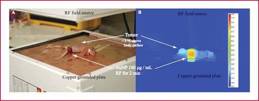 Fig. 5. Nude balb/c mice with pancreatic xenografts in the right flank were sedated and grounded to a copper plate with conducting copper tape in order to prevent excess current inducing electrothermal injury (A). Tumors heat significantly more so than the mouse body due to C225-mediated AuNP delivery (B). In addition, 100 μg/mL of AuNPs in deionized water heat in an RF field whereas the conducting copper tape protects mice extremities (ears, tails, and paws) from excess current and electrothermal injury.