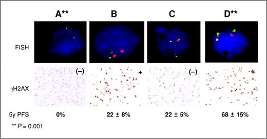 BRAF-KIAA1549 Fusion Predicts Better Clinical Outcome in Pediatric Low ...