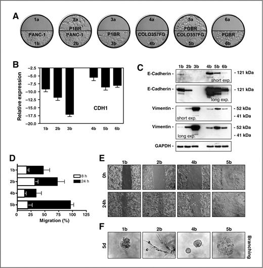 Figure 6. Induction of EMT by secreted proteins in anti-VEGF treatment–resistant pancreatic cancer cells. A, schematic representation of the coculture technique used to culture anti-VEGF treatment–resistant and treatment-sensitive pancreatic cancer cells physically separated by a hydrophobic barrier but in the same culture medium. Samples of different cell lines cultured under different conditions are indicated as follows: 1a = empty, 1b = PANC-1, 2a = P1BR cocultured with PANC-1, 2b = PANC-1 cocultured with P1BR, 3a = empty, 3b = P1BR, 4a = empty, 4b = COLO357FG, 5a = FGBR cocultured with COLO357FG, 5b = COLO357FG cocultured with FGBR, 6a = empty, and 6b = FGBR. B, results of quantitative RT-PCR analysis of the E-cadherin (CDH1) gene presented as the fold change in RNA expression between the gene of interest and β-actin. The mean values and 95% CIs from 3 independent experiments conducted in quadruplicate are shown. C, expression of E-cadherin and vimentin proteins. The results shown are representative of 3 independent experiments conducted. D, pancreatic cancer cell migration. The results are presented as the percentages of the total distances between the wound edges enclosed by cancer cells. The mean values and 95% CIs from 3 independent experiments conducted in quadruplicate are shown. E, photographs of the wound area were taken immediately and 24 hours after the incision. F, cell invasion assays. Representative photographs of branching morphogenesis in 3D Matrigel of pancreatic cancer cells. GAPDH, glyceraldehyde-3-phosphate dehydrogenase.