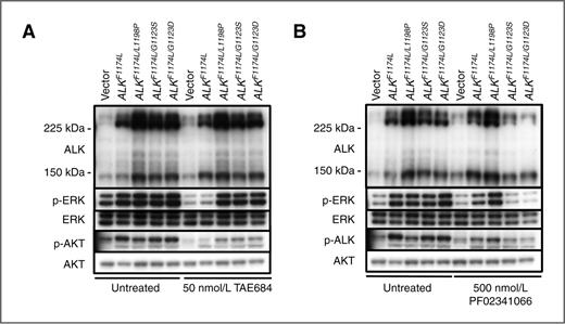 Figure 5. G1123S/D and L1198P mutations induce a distinct resistance phenotype to ALK inhibitors. A, SH-SY5Y cells expressing the indicated mutations were treated with TAE684 for 8 hours or left untreated. Whole-cell lysates were analyzed for levels of ALK, p-ERK, ERK, p-AKT, and AKT by immunoblotting. B, SH-SY5Y cells expressing the indicated mutations were treated with PF02341066 for 8 hours or left untreated. Whole-cell lysates were analyzed for levels of ALK, p-ERK, ERK, p-AKT, and AKT by immunoblotting.