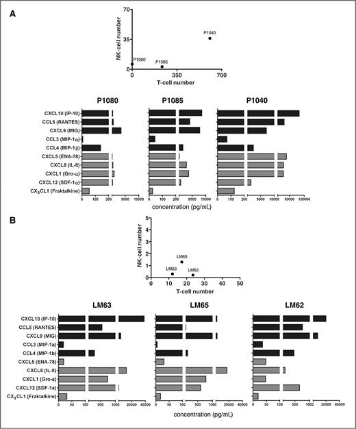 Figure 5. Comparison of T- and NK-cell infiltration and corresponding chemokine concentrations. Primary CRC tissues of 3 representative patients P1080, P1085, and P1040 (panel A) and CRC liver metastatic tissues of 3 different patients, LM62, LM63, and LM65 (panel B) were analyzed for T- and NK-cell infiltration (cell numbers/mm2) and the corresponding protein concentrations of the NK-relevant chemokines. The numbers of infiltrating T and NK cells are shown for each patient in the upper part of the panels (for primary CRCs and CRC liver metastases). For each patient sample, the chemokine concentrations are displayed below for primary CRC and CRC liver metastases. For additional data see Supplementary Figure S5.
