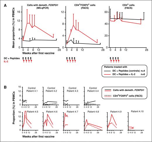 Figure 3. Treg frequencies in patients vaccinated with DCs pulsed with peptides combined or not to IL-2 injections: (A) Frequencies of cells with demethylated FOXP3i1 were measured by MS-qPCR (graph on the left). Frequencies of CD4+FOXP3+ (middle graph) and of CD4+ lymphocytes (graph on the right) were determined by flow cytometry. All analyses were performed on PBMC samples collected at the indicated time points from patients vaccinated either with DC + peptides (black lines), or with DC + peptides + IL-2 (red lines). Schedules of DC + peptide injections (black arrows) and IL-2 injections if any (red arrows) are indicated below the X-axis. Data represent mean values for the indicated number of patients + SD. (B) Same as in (A), but data is shown for each individual patient (graphs on bottom: patients receiving DC + peptides + IL-2; graphs on top: patients receiving DC + peptides only), with MS-qPCR results illustrated as plain lines, and FACS results as dotted lines.