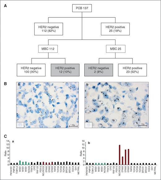 Figure 2. HER2 variation in primary and metastatic breast cancer: A, The flow chart summarizes HER2 change during disease progression in the entire series of 137 primary and metastatic breast cancers. One hundred and twenty-three cases (100 HER2 negative and 23 HER2 positive) maintained the same HER2 status (90%; white boxes) whereas 14 cases (10%) changed HER2 status (gray boxes), P = 0.04. B, SISH images demonstrate: (a) no HER2 amplification in a primary breast cancer (gene copy numbers ≤6) and (b) HER2 moderate gene amplification in the metachronous liver metastasis (gene copy numbers >10); Scale bar = 10 μm. C, the BC illustrated in panel b has been also analyzed by MLPA showing: (a) a normal HER2 status in PBC and (b) an amplified HER2 status in the paired metastasis (HER2 ratio 1.36 vs. 8.02). PBC, primary breast cancer; MBC, metastatic breast cancer; HER2 negative, score 0, 1+, 2+ nonamplified; HER2 positive, score 2+ amplified, 3+.