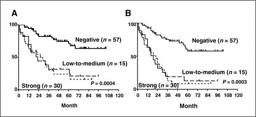 Figure 2. OS (A) and PFS (B) curves of patients with PTCL-NOS according to the expression of cytoplasmic nm23-H1.