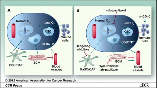 Figure 4. Schematic of the TME network, cross-talk, and interdependence in PDA with a focus on therapeutic intervention points. A, activated pancreatic stellate cells lay down vast amounts of ECM, which causes a constriction/collapse of the sparse vessel network. This impedes gemcitabine delivery. Hypoxia generates niches for slow-cycling cells that are not targeted by chemotherapeutics. Also, an immunosuppressive microenvironment further supports tumor growth. B, Hedgehog pathway inhibition causes stromal depletion accompanied by reduced ECM. The ECM can also be enzymatically targeted, and both interventions lead to increased vessel patency and intratumoral gemcitabine delivery. The immune system can be stimulated to turn against cancer cells, for instance by anti-CD40 antibody treatment. CAF, cancer-associated fibroblast.