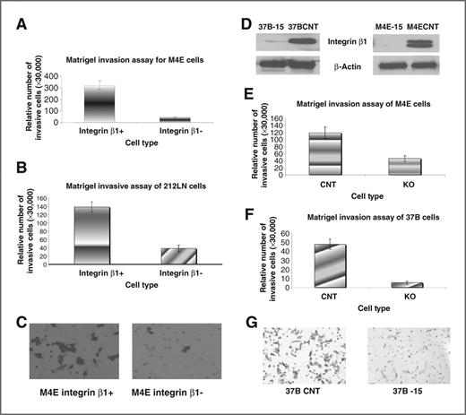 Figure 2. Integrin β1 affects the invasive ability of SCCHN cell lines. (A) and (B) show that in both M4E (A) and 212 LN (B) cells, the integrin β1–positive population shows a significantly higher invasive ability than the integrin β1–negative population. C, there are more invasive integrin β1+ M4E than integrin β1− M4E cells at the lower part of the chamber membrane (magnification, ×200). D, integrin β1 was knocked down using integrin β1–specific shRNA expressed by pLVTHM lentivirus vector in PCI-37B and M4E cells to create M4E-15 and PCI-37B-15 cells, respectively. Knockdown of integrin β1 expression significantly reduced the invasive ability of M4E (E) and PCI-37B (F) cells. The analysis of invasive cells from each cell line was repeated 3 times. G, more invasive 37B control cells than 37B-15 integrin β1 knockdown cells on the lower part of the chamber membrane (magnification ×200). CNT, control cells; KO, integrin β1 knockdown cells.