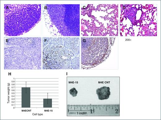 Figure 3. M4E control cells, but not their integrin β1 knockdown counterparts, developed lymph node and lung metastasis. No metastatic cancer cells were observed in lymph node (A) and lung (C) in M4E-15 injected mice, whereas tumor developed from the control M4E cells further migrated to both lymph node (B) and lung (D). IHC staining of xenograft tumor tissues using an integrin β1-specific antibody showed no integrin β1 expression in xenograft tumor developed from M4E-15 cells (E), and confirmed integrin β1 expression in control M4E cells (F). G, integrin β1 expression in metastatic lesion (lymph node metastatic tumor; magnification ×200). H, control M4E cells developed significantly larger tumor in the xenograft model compared with their integrin β1 knockdown counterparts. Student t test was conducted to determine the difference in weight between the 2 groups. I, control M4E developed larger and heavier tumors (0.69 ± 0.19 g) than M4E-15 cells (0.31 ± 0.18 g; P < 0.002).