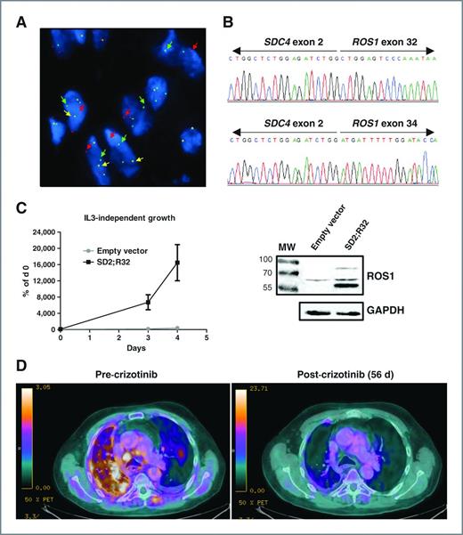Identifying and Targeting ROS1 Gene Fusions in Non–Small Cell Lung ...