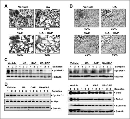 Figure 5. Ursolic acid enhances the ability of capecitabine to inhibit the expression of NF-κB and genes linked to proliferation, invasion, angiogenesis, and metastasis of CRC tumors. Immunohistochemical analysis of nuclear p65 (A) and β-catenin (B) in tumor tissues. Percentages indicate positive staining for the given biomarker. C, Western blot analysis of phospho-STAT3 (left) and EGFR phosphorylation (right). D, Western blot analysis of proteins involved in proliferation (cyclin D1and c-myc), cell survival (Bcl-2, Bcl-xL, and survivin). Three samples were taken from each group.