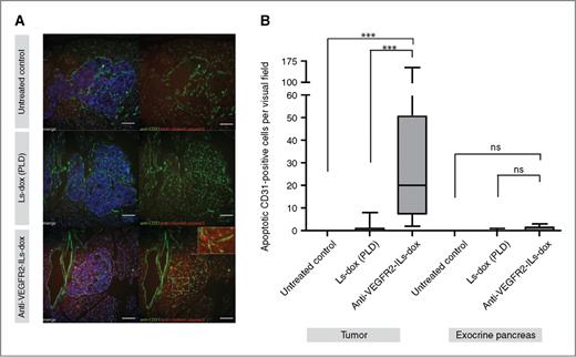 Figure 4. Anti-VEGFR2 ILs-dox treatment leads to endothelial apoptosis in the tumor. A, immunoflourescence analysis of Rip1Tag2 mice of tumor-associated and physiologic vessels in the endocrine and exocrine pancreas. Untreated control (top row), PLD (middle row), or anti-VEGFR2-ILs-dox (bottom row). Apoptosis was visualized with an anti-cleaved caspase 3 antibody (red) and vessels were stained with an anti-CD31 antibody (green), blue = DAPI. Specific endothelial cell apoptosis was analysed (insert, bottom row). Scale bar = 50 μm. B, apoptosis significantly increases in CD31-positive tumor-associated endothelial cells of Rip1Tag2 mice treated with anti-VEGFR2-ILs-dox compared with PLD or untreated control mice, but had no effect in the vasculature of the exocrine pancreas. Apoptotic cells were assessed per 400× high power field. Bars = mean ± SD, ***, P < 0.001 (Kruskal–Wallis posttest). ns, not significant.