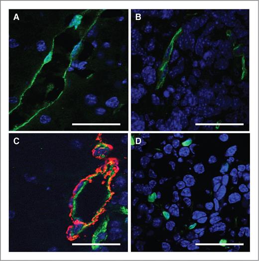 Figure 5. Immunofluorescence analysis of tumor-associated and physiologic vessels. A, vessel in the exocrine pancreas of a Rip1Tag2 mouse treated with anti-VEGFR2 ILs-dox. This is an intact microvessel formed of a single layer of endothelial cells. Green = staining for CD31, blue = DAPI. B, capillaries in the tumors of a Rip1Tag2 mouse treated with PLD. The endothelial cells form again a single layer tube. Green = staining for CD31, blue = DAPI. C, vessel at the rim of a tumor in a Rip1Tag2 mouse treated with anti-VEGFR2-ILs-dox. This is a larger vessel composed of an endothelial and a smooth muscle cell layer that stayed intact despite the treatment with anti-VEGFR2-ILs-dox. Green = CD31, red = smooth muscle, blue = DAPI. D, apoptotic endothelial cells in a tumor of a Rip1Tag2 mouse treated with anti-VEGFR2-ILs-dox. The endothelial cells still express CD31, but they have become pyknotic and do not form capillaries any more. Green = CD 31, blue = DAPI. Scale bar A–D = 10 μm.