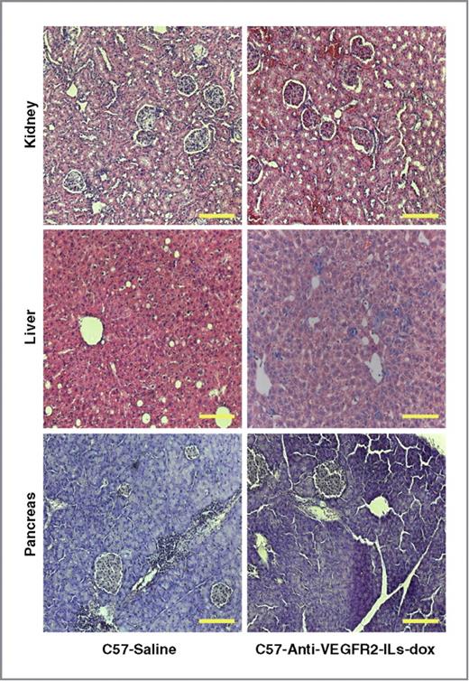 Figure 6. Treatment with anti-VEGFR2-ILs-dox does not cause organ toxicity. Microphotographs of H&E stained sections of pancreas, liver, and kidneys from C56Bl/6 mice injected with anti-VEGFR2-ILs-dox or saline are shown. The mice were sacrificed 18 months after treatment and the internal organs were analysed morphologically for signs of toxicity. There was no morphologic difference between organs in the saline cohort and in the anti-VEGFR2-ILs-dox cohort. Scale bar = 100 μm.