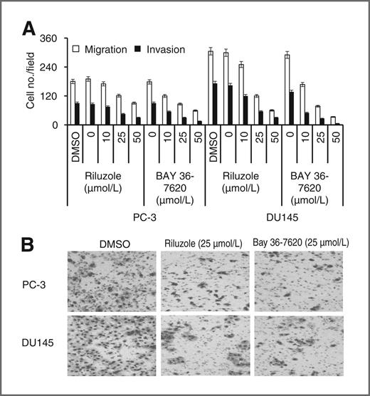 Serum Glutamate Levels Correlate with Gleason Score and Glutamate