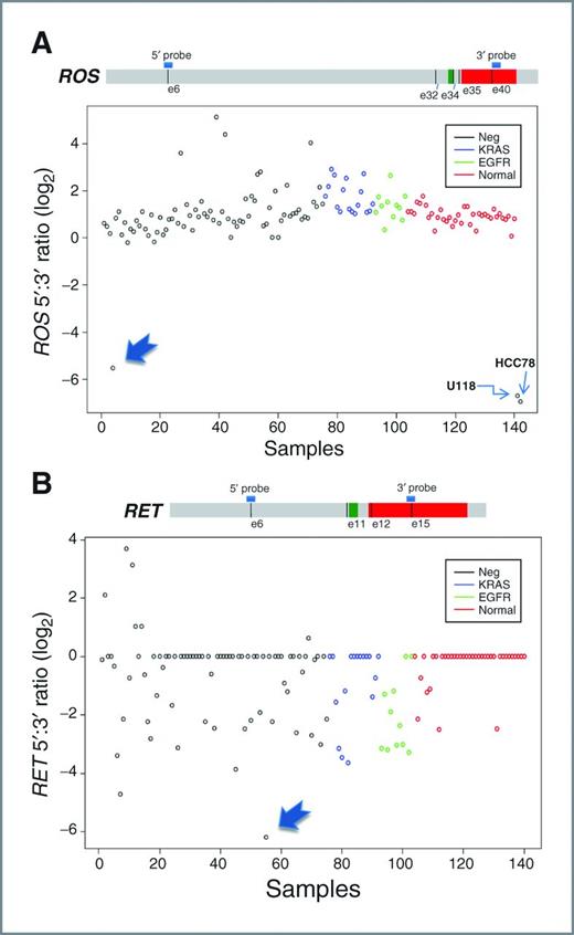 Identification of KIF5B-RET and GOPC-ROS1 Fusions in Lung ...
