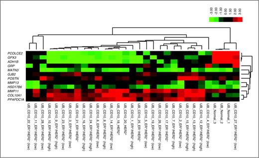 Figure 1. Heat map representing the expression of the genes included in the CD10+ stroma signature in the normal and tumor-associated CD10+ cells (red represents high expression values and green low expression values). The molecular subtypes of the tumor samples are illustrated for each tumor sample. ER and HER2 were both assessed by immunohistochemistry. ER+/HER2− (low) were ER+/HER2− tumors of grade 1 or 2 and ER+/HER2− (high) were ER+/HER2− tumors of grade 3.