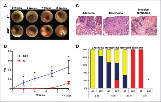Figure 1. Heterozygous KrasG12D in AKP GEMM strains accelerates tumor formation. A, representative endoscopic images of AP and AKP tumors taken every 2 to 3 weeks. B, growth curves measured from endoscopy show that the AKP strains develop at a faster rate by approximately 8 times than AP at 10 weeks. C, resulting primary tumors range from adenomas to carcinomas to invasive carcinomas (representative images of each are shown). D, frequency of tumor development after AdCre injection.
