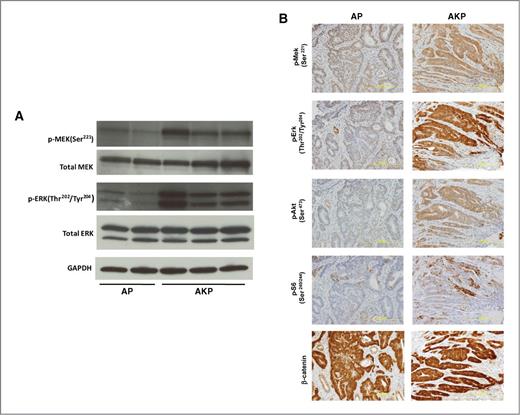 Figure 2. Elevated levels of MAPK, PI3K, and mTOR signaling in tumors from AKP strain. A, Western blots for MAPK proteins using dissected tumor lysates from AP and AKP strains. Phospho- (pMekSer221 and p-ErkThr220/Tyr204) levels of MAPK signaling are elevated in AKP, whereas total (Mek and Erk) levels are unchanged. B, immunohistochemical staining in AP and AKP tumor sections. In AKP strains, elevated levels of MAPK (p-MekSer221 and p-ErkThr220/Tyr204), PI3K (p-AktSer473), mTorc (p-S6Ser240/244), and WNT (β-catenin) signaling are observed. GAPDH, glyceraldehyde-3-phosphate dehydrogenase.