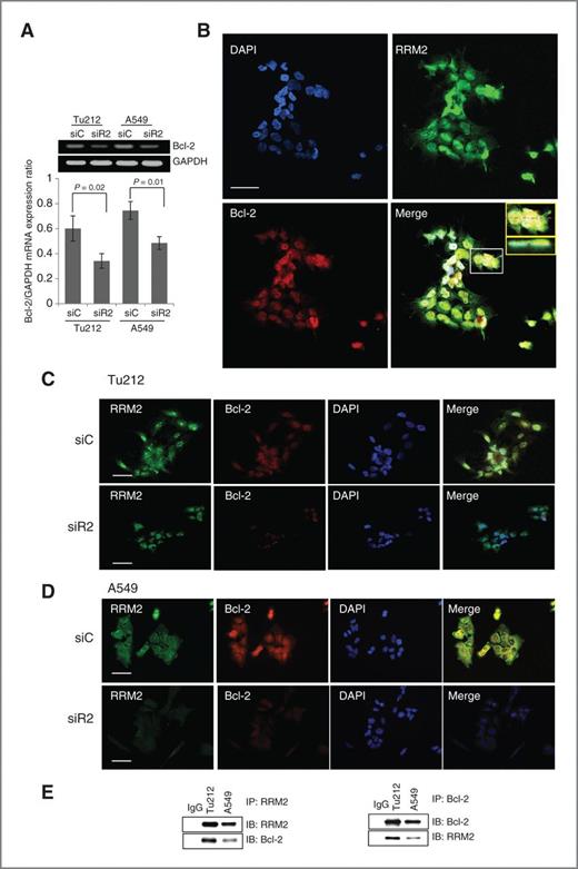 Figure 5. RRM2 regulates Bcl-2 through direct protein–protein interaction and partially influences Bcl-2 mRNA. A, RT-PCR for Bcl-2 and GAPDH mRNA levels 72 hours after transfection of Tu212 and A549 cells with 5 nmol/L siC or siR2. RRM2 was normalized to GAPDH levels within the same sample. B, Tu212 cells were stained with anti-RRM2 (green) and anti-Bcl-2 (red), and nuclei were counterstained with DAPI (blue). A z-stack of optical sections was created at 0.59-μm intervals using a confocal microscope (LSM 510; Carl Zeiss MicroImaging, Inc.). Inset, top shows magnification of white box in merged figure. Inset, bottom shows z-axis reconstructions along the bars indicated in inset top. Bar, 50 μm. (C) Tu212 and (D) A549 cells were stained with anti-RRM2 (green), anti-Bcl-2 (red), and nuclei (blue) 48 hours after transfection with 5 nmol/L siC or siR2. Bar, 50 μm. E, Co-immunoprecipitation (IP) with anti-RRM2 (left) or anti-Bcl-2 (right) and immunoblotting with anti-Bcl-2 or anti-RRM2 in Tu212 and A549 cells. IM, immunoblotting.