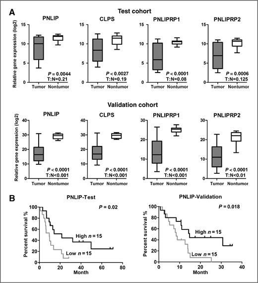 Figure 2. Gene expressions of PNLIP, CLPS, PNLIPRP1, and PNLIPRP2 in two independent cohorts of PDAC. A, PNLIP, CLPS, PNLIPRP1, and PNLIPRP2 are decreased in tumors as compared with adjacent non-tumor tissues in test and validation cohorts. Box plots represent gene expression level with relative intensity (log2) of microarray data in the test cohort or relative threshold cycle value (Ct) normalized with endogenous control gene GAPDH using qRT-PCR data in validation cohort. Bars indicate median value. Student t tests P value and tumor: nontumor ratios (T:N) are indicated in the graphs. B, Kaplan–Meier analysis of PNLIP in test and validation cohorts. Gene expression of PNLIP is dichotomized into high and low groups using a median cutoff. Log-rank P value is indicated in the graphs.