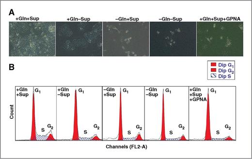 Figure 4. Effect of Gln depletion and SLC1A5 inhibition on cell-cycle progression. A, representative bright field (× 20 magnification) images of A549 cells after 48 hours culturing in various growth conditions as described below. B, DNA histograms of cell-cycle phase distribution of 104 cells after 48 hours of culturing A549 cells in growth media supplemented with EGF, insulin, selenium and transferein, and 2 mmol/L of Gln (+Gln+Sup), or Gln but no supplements (+Gln−Sup), or no Gln but with supplements (−Gln+Supp) or not supplemented with neither Gln nor supplements (−Gln−Supp), or with (+Gln+Sup) and that contain 5 mmol/L of GPNA.