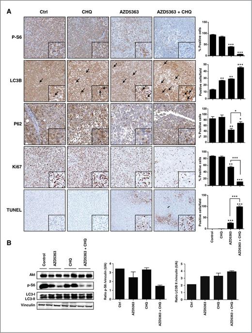 Figure 6. AZD5363 and chloroquine cause apoptosis in xenograft model. A, tumors were collected after sacrifice and p-S6, Ki67, LC3, and terminal deoxynucleotidyl transferase–mediated dUTP nick end labeling (TUNEL) were evaluated by immunohistochemical analysis (original magnification, × 200). Specimens were scored and estimated in positive cells per field or in percentage of positive cells. B, total proteins were extracted from the xenograft tumors and Akt, p-S6, LC3-I, and LC3-II were analyzed by Western blotting. The relative levels were normalized with vinculin and estimated in densitometric units ± SEM; ***, P < 0.001; **, P < 0.01; *, P < 0.05.