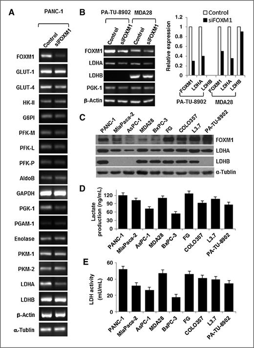 Figure 1. Regulation of the Warburg effect by FOXM1. A, RT-PCR analysis of the mRNA expression for glycolytic enzymes in PANC-1 cells after knockdown of FOXM1 expression. Expression of PGK-1 and LDHA was significantly downregulated. β-Actin and α-tubulin were used as controls. B, RT-PCR analysis of the mRNA expression for FOXM1, LDHA, LDHB, and PGK-1 in PA-TU-8902 and MDA Panc-28 cells after knockdown of FOXM1 expression. C, Western blot analysis of FOXM1, LDHA, and LDHB expression in pancreatic cancer cells. D, analysis of the lactate production in pancreatic cancer cell lines using a Lactate Assay Kit. E, analysis of the LDH activity in pancreatic cancer cell lines using an LDH Activity Assay Kit.