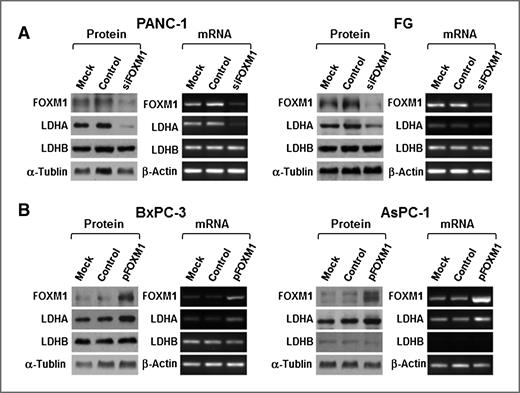 Figure 3. Regulation of LDHA expression by FOXM1. A and B, PANC-1 and FG cells were transfected with siFOXM1 or control siRNA (A), and BxPC-3 and AsPC-1 cells were transfected with pcDNA3.1-FOXM1 or pcDNA3.1 (B). The cultures were incubated for 48 hours. Total protein and RNA lysates were harvested to measure the FOXM1, LDHA, and LDHB expression using Western blot (left) and RT-PCR (right) analysis.