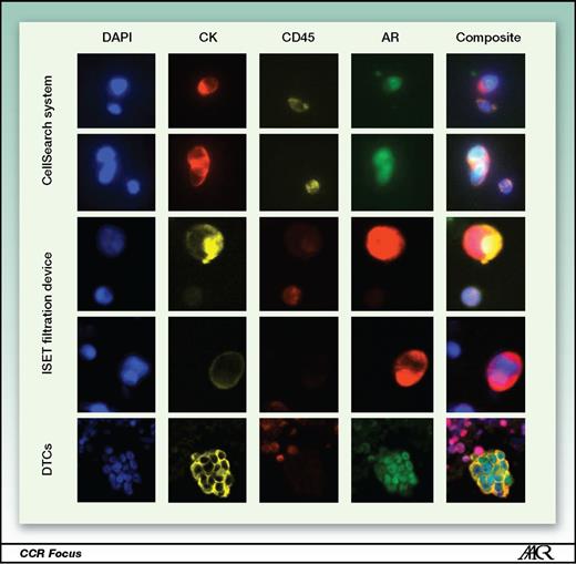 Circulating Tumor Cells: A Multifunctional Biomarker | Clinical Cancer ...