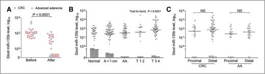Figure 2. Associations between stool miR-135b and clinical features. A, changes of the stool miR-135b level after removal of tumors (squares) or advanced adenomas (triangles). Samples aligned on the x-axis represent those with undetectable miRNA level. P values indicate significant difference determined by the Wilcoxon matched pairs test. The stool miR-135b level in subjects categorized by lesion stage (B) and lesion location (C). On the basis of lesion stage, subjects were categorized into five groups: individuals of normal colonoscopy (normal, n = 109), patients with adenoma of diameter smaller than 1 cm (A < 1 cm, n = 110), patients with advanced adenoma (AA, n = 59), patients of tumor-node-metastasis (TNM) stages I and II (T 1 2, n = 24), and patients of TNM stages III and IV (T 3 4, n = 76), respectively. P value for test for trend denotes significance measured by the Jonckheere–Terpstra nonparametric test for trend. On the basis of lesion location, CRC, and advanced adenoma (AA) patients were categorized into proximal CRC (n = 29) and distal CRC (n = 75), proximal AA (n = 26) and distal AA (n = 31). NS denotes no statistical significance. miRNA levels were expressed in number of copies per nanogram of extracted RNA. Open circles represent samples with undetectable miRNA level. The lines denote the medians.
