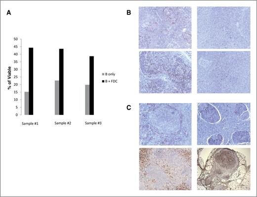 Figure 5. FDCs increase CD19+ follicular lymphoma cell survival. FDCs were cocultured with follicular lymphoma patient samples using positively selected CD19+ cells at a ratio of 2.5:1. After 48 hours, the viability of the CD19+ follicular lymphoma cells was assessed by Annexin V/propidium iodide. The presence of FDC was associated with significant increase in viability of CD19+ cells (P = 0.003). B, sequential biopsies from diagnosis to transformation from two representative patient samples demonstrate a transition from PD1+ cells in the follicle to a diffuse pattern as patient nears transformation. C, CD14+ cells change across time from a nonfollicular to follicular pattern.