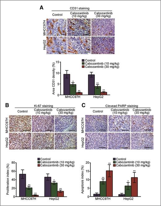 Figure 6. Effects of cabozantinib on angiogenesis, cell proliferation, and apoptosis of MHCC97H and HepG2 xenografts. Mice bearing tumor xenografts were treated as described in Materials and Methods. A, representative pictures of blood vessels stained with anti-CD31; B, proliferative cells stained with Ki-67; C, apoptotic cells stained with anti-cleaved PARP antibodies in tumors. The bar graph, mean ± SD of quantification of CD31-positive areas, Ki-67– and PARP-positive cells from immunohistochemical analysis of tumors. *, P < 0.05; **, P < 0.01; the treated group versus the control group; scale bars, 100 μm.