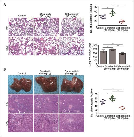 Figure 7. Effect of sorafenib and cabozantinib on the metastasis of SK-HEP1 in nude mice. Following the experimental design as described in Materials and Methods, nude mice were sacrificed at day 28 to evaluate lung and liver metastases. The image is a representative H&E-stained section of lung (A) and liver metastases (B), and the average number of foci is presented as the mean ± SD. *, P < 0.05; **, P < 0.01; the treated group versus the control group; scale bars in A and B ×40, 500 μm; scale bars in A and B ×200, 100 μm.