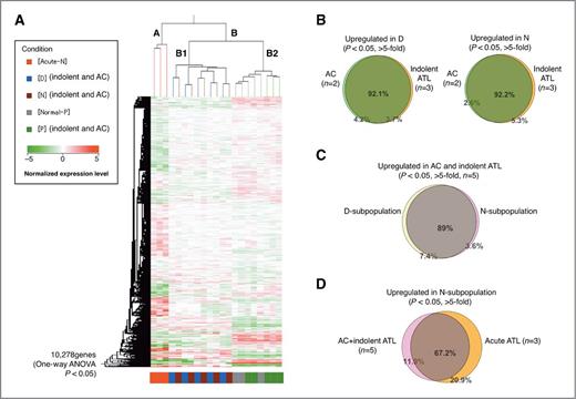 Figure 5. Comprehensive gene expression analysis of the three subpopulations in the CADM1 versus CD7 plot. A, we conducted an unsupervised hierarchical clustering analysis of 10,278 genes whose expression levels were significantly changed in the P subpopulation of normal controls (n = 3); P, D, and N subpopulations of asymptomatic carriers and indolent ATLs (n = 5); and N subpopulation of acute-ATLs (n = 3; one-way ANOVA, P < 0.05). The P and D subpopulations of acute ATLs and D and N subpopulations of normal controls could not be analyzed because of insufficient numbers of cells. Clustering resulted in three major clusters: (i) P subpopulations of normal controls (gray) and asymptomatic carriers/indolent ATLs (green); (ii) D and N subpopulations of asymptomatic carriers/indolent ATLs (blue and brown, respectively); and (iii) N subpopulations of acute ATLs (red). These results indicate that the P subpopulations of asymptomatic carriers/indolent ATLs have characteristics similar to those of normal uninfected cells, whereas the D and N subpopulations of asymptomatic carriers/indolent ATLs have genetic lesions in common. The N subpopulations of acute ATLs are grouped in an independent cluster, meaning that these malignant cell populations have a significantly different gene expression profile, even compared with the N subpopulations of indolent ATLs. B, similarity between asymptomatic carriers and indolent ATLs. The Venn diagrams show that 92.1% and 92.2% of genes upregulated in the D and N subpopulations, respectively, compared with “Normal-P” (P < 0.05), were common to asymptomatic carriers (n = 2) and indolent ATLs (n = 3). C, similarity between the D and N subpopulations. The Venn diagram shows that 89% of genes upregulated in the D and N subpopulation, compared with Normal-P (P < 0.05), overlapped. D, comparison of the N subgroups between acute-ATLs (n = 3) and asymptomatic carriers/indolent ATLs (n = 5). As shown in the Venn diagram, 67.2% of genes were upregulated (P < 0.05) in the N subpopulations of both acute ATLs and asymptomatic carrier/indolent ATLs. However, a significant number of genes (20.9%) were upregulated only in the N subpopulation of acute ATLs.