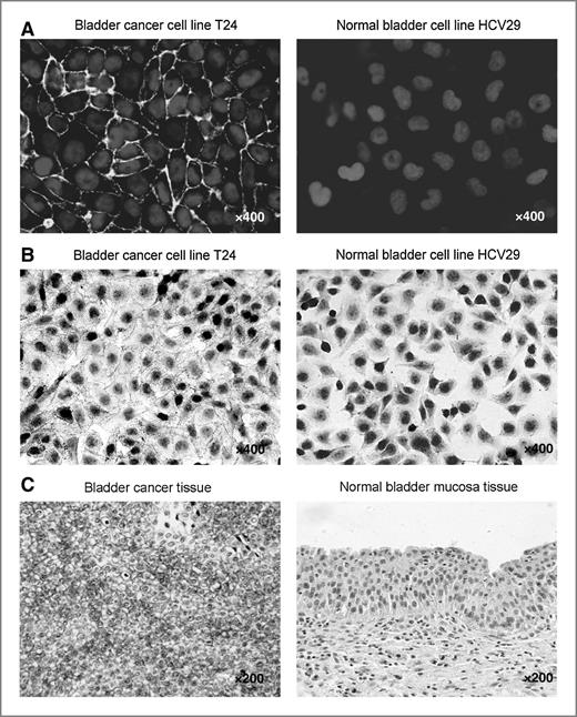Figure 1. Specific recognition of the BCMab1 antibody to cancerous lines and tissues of bladder cancer. A and B, BCMab1 recognized its antigen on the bladder cancer cell line T24 cells, but not on the normal bladder cell line HCV29 by immunofluorescence and immunohistochemistry assays. C, BCMab1 recognized its antigen on the bladder cancer tissue, but not on the normal bladder mucosa tissue (immunohistochemistry).