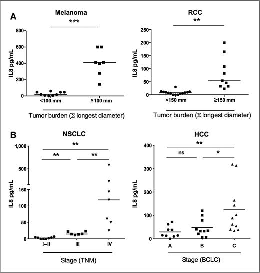 Figure 2. IL8 serum concentrations reflect tumor burden and extension. A, serum IL8 concentrations in two series of prospectively banked samples from melanoma (n = 16) and RCC (n = 23) for which tumor burden was assessed by image studies and physical examination. High (≥100 mm melanoma; ≥150 mm RCC) and low (<100 mm melanoma; <150 mm RCC) tumor burden patients were categorized showing different levels of IL8 (median IL8 high-tumor burden: melanoma, 412 pg/mL; RCC, 54 pg/mL and low-tumor burden: melanoma, 19.57pg/mL; RCC, 7.8 pg/mL). B, measurements as in A, in a series of serum samples from NSCLC (n = 21) and HCC (n = 30), in relation to the AJCC and BCLC staging classifications, respectively. The lines show the median value for each group and statistical comparisons were made with Mann–Whitney U tests. (ns, nonsignificant; *, P < 0.05; **, P < 0.01; ***, P < 0.001).