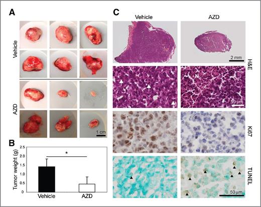Figure 4. Systemic administration of AZD inhibits growth of subcutaneous BTIC xenografts. A to C, treatment of mice bearing established BTIC subcutaneous xenograft tumors with thrice weekly i.p. injections of AZD inhibited tumor growth (A) and significantly reduced tumor weight (B) compared with vehicle controls after 2 weeks (*, P < 0.01; Mann–Whitney test). C, H&E staining demonstrated densely cellular tumor tissue with frequent mitotic figures (arrows) in vehicle-treated xenografts, whereas there were few mitotic figures and large areas of geographic necrosis (N) in AZD-treated xenografts. Immunostaining for the proliferative marker Ki67 was decreased whereas TUNEL reactivity (arrowheads), indicating apoptotic cells, was dramatically increased in AZD-treated xenografts compared with vehicle controls (C).