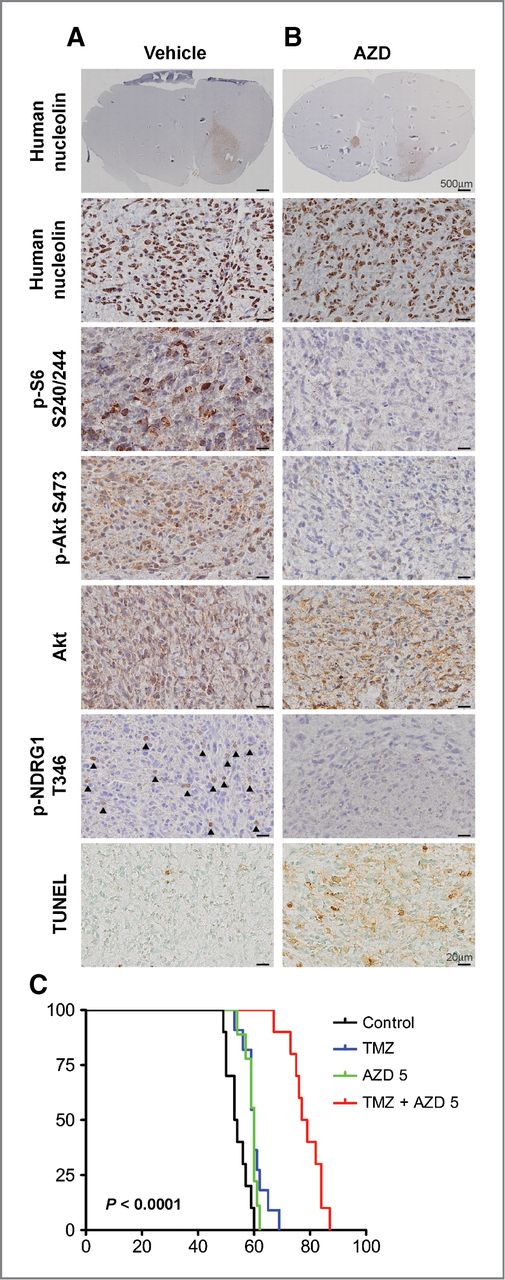 Figure 5. Systemic administration of AZD inhibits intracranial mTORC1/2 signaling leading to apoptosis of tumor cells and synergizes with TMZ. A and B, staining with an antibody specific for the human homolog of nucleolin demonstrated the presence of a BTIC xenograft tumor in the deep gray matter. AZD dramatically decreased phosphorylation of S6 in treated animals demonstrating on-target inhibition of mTORC1 signaling. Phosphorylation of the S473 residue of Akt and the T346 residue of NDRG1 was decreased without affecting levels of total Akt, thus demonstrating on-target inhibition of mTORC2 signaling. Arrowheads, xenograft cells with cytoplasmic staining for phosphorylated NDRG1. AZD treatment resulted in increased staining with TUNEL demonstrating apoptosis in tumor cells following mTORC1/2 inhibitions in vivo. C, oral administration of AZD and TMZ significantly increased median survival of BTIC147 xenograft animals as compared with that with TMZ alone or AZD alone (78 vs. 60 days; P < 0.0001; log-rank test).