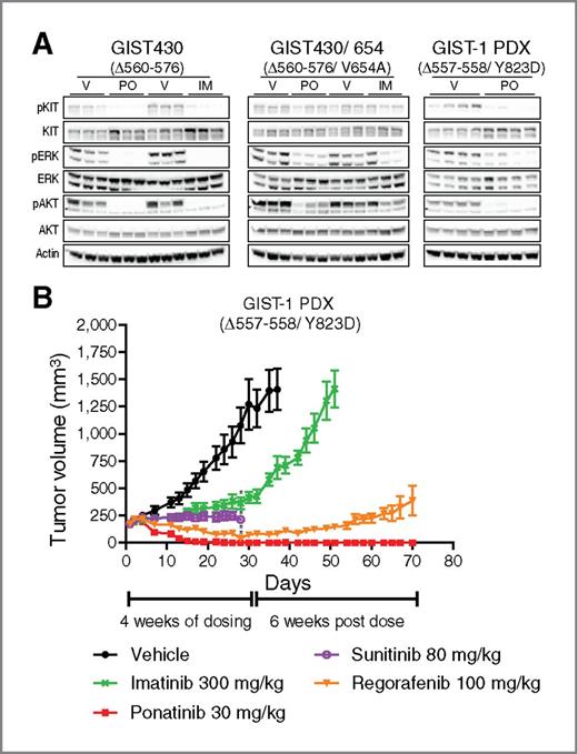 Figure 4. Ponatinib activity in patient-derived KIT-driven tumor models. A, KIT phosphorylation and downstream signaling were evaluated by immunoblot in GIST430, GIST430/654, and GIST-1 PDX-implanted animals treated with a single oral dose of vehicle (V), 30 mg/kg ponatinib (PO), or 300 mg/kg imatinib (IM), n = 3 per group. B, in vivo efficacy of ponatinib, imatinib, sunitinib, and regorafenib in GIST-1 PDX model. Tumor-bearing animals were treated once daily by oral gavage with vehicle or the indicated dose of drug for the indicated dosing period. Mean tumor volume and SEM are plotted. The vehicle used for ponatinib and sunitinib is shown (citrate buffer); nearly identical tumor growth was observed for the vehicles used for imatinib (water) and regorafenib (NMP/PEG; data not shown). Statistical significance, calculated using one-way ANOVA (P < 0.05) in which each treatment group (day 28) was compared to its vehicle control, is indicated by an asterisk. Data are shown for all groups until fewer than 8 of the original 10 mice in each group remained. In the vehicle and imatinib groups, mice were sacrificed when tumors became too large. In the sunitinib treatment group, multiple mice were sacrificed because of >20% body weight loss.