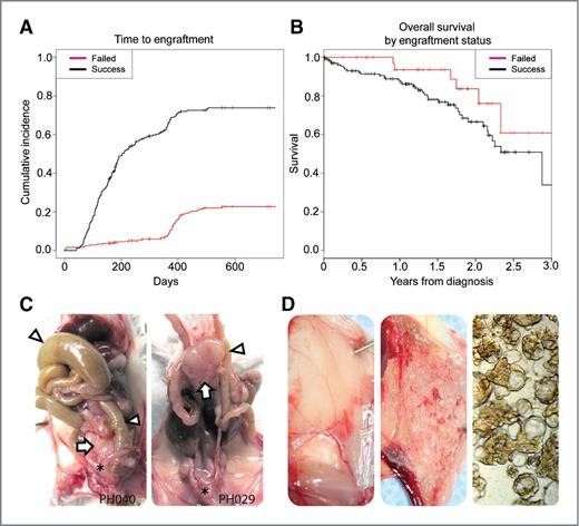 Figure 1. Clinical correlation between tumorgraft and patient. A, tumorgraft engraftment rate over time, where “success” indicates successful engraftment in at least one mouse and “failed” indicates failed engraftment. B, patient's overall survival by tumorgraft engraftment status, where “success” and “failed” are as in A. C, representative images from mice showing intraperitoneal dysfunction. A tumorgraft (arrow) behind the uterus (*) caused marked bowel (triangle) obstruction (left) in one mouse, but a mesenteric tumor produced nonobstructive weight loss and anorexia in another mouse (right). D, a representative mouse with the abdominal wall reflected and showing normal, smooth-appearing peritoneum with visible vessels (left). The peritoneal surface of a mouse that developed ascites (center) demonstrates a thick cellular layer consistent with carcinomatosis. Visualization of ascitic fluid by light microscopy (right) revealed aggregates of epithelial cells (spherules).