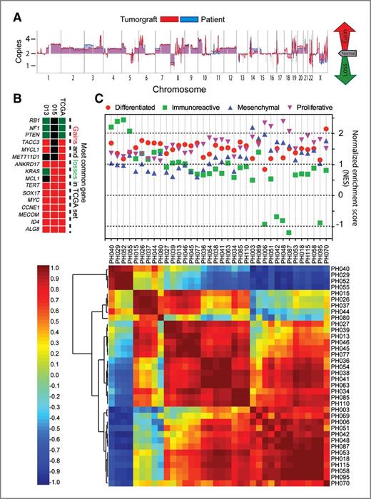 Figure 3. Molecular analysis of tumorgrafts. A, the graphical representation of array CGH at the chromosome level from source patient (blue) and tumorgraft (red) in model PH015 (high-grade endometrioid). B, heat map comparison of frequently lost (green) and gained (red) genes is the TCGA dataset (right column) compared with two representative tumorgrafts (PH015 and PH013, a high-grade serous). C, top, normalized enrichment scores (NES) of 36 tumorgrafts according to the CLOVAR (classification of ovarian cancer) gene signature. Varying degrees of enrichment for signatures associated with differentiated (red circle), immunoreactive (green square), mesenchymal (blue triangle up), and proliferative (purple triangle down) molecular subtypes were observed. Bottom, a heat map of 36 tumorgraft models clustered as a function of their gene expression correlation with each other. Highest (red), inverse (blue), and zero correlation was used to cluster tumorgrafts by their overall correlation.