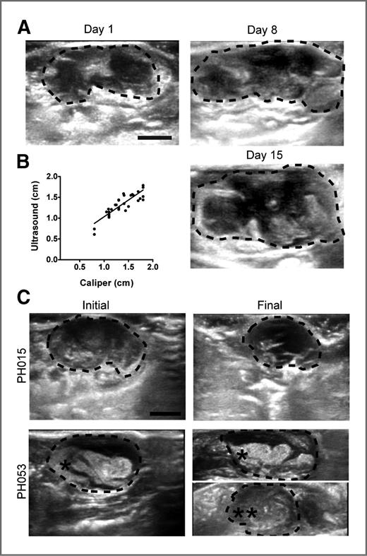Figure 4. Transabdominal ultrasound assessment of tumor change. A, representative serial ultrasound images from a saline-treated PH015 tumorgraft (dotted outline) showing growth over 15 days. B, tumor diameter in 32 mice bearing tumorgrafts was assessed by ultrasound and plotted against caliper-derived diameter measurements at necropsy. The Spearman correlation was high (r = 0.8491). C, representative tumorgraft ultrasound images showing response to treatment. A target tumor (*) was present on day 1 but a nontarget tumor (**) developed during treatment. All panels: scale bar, 5 mm; circumferential dotted line, tumor cross-sectional area.