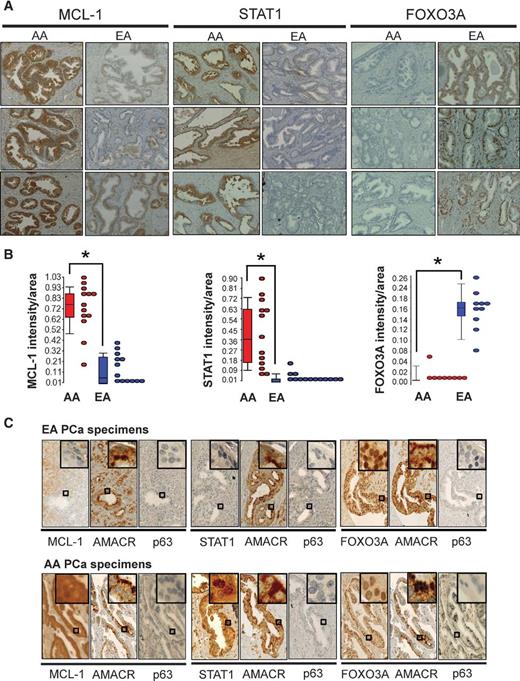 Figure 5. IHC reveals differential protein expression in AA prostate cancer (PCa) versus EA prostate cancer. A, paraffin-embedded tissue sections of human prostate cancer specimens show strong MCL-1 and STAT1 expression in the cytoplasm of cancer cells of AA specimens, whereas FOXO3A immunoreactivity was detected in cancer cell nuclei of EA specimens. Images shown are representative of 13 AA and 13 EA specimens from different patients. B, the intensities of cytoplasmic MCL-1 and STAT1, and nuclear FOXO3A were quantified by using the ratio of total intensity of immunoreactive MCL-1, STAT1, or FOXO3A over the total area of cells in the images. Data, box plots of n = 13 AA or EA samples, with *, P < 0.05 using the Student t test. C, serial FFPE sections derived from AA and EA prostate cancer patients were immunostained for AMACR (a prostate cancer marker), p63 (a normal basal cell marker) and the protein of interest (MCL-1, STAT1, or FOXO3A). Enlarged pictures (rectangles as indicated) enhance the nuclear or cytoplasmic distribution of these proteins at the cellular level.