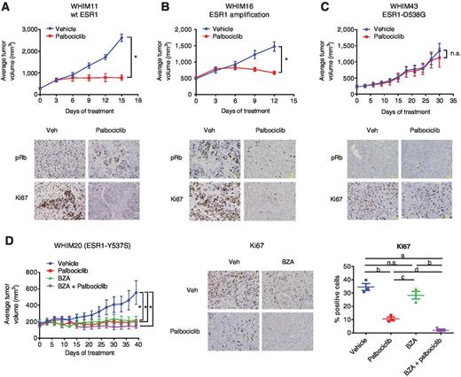 Figure 5. Palbociclib and BZA inhibit the growth of xenograft tumors derived from patients resistant to endocrine interventions. A–C, WHIM11 (A), WHIM16 (B), or WHIM43 (C) PDX tumors were implanted into intact NSG mice. Animals bearing tumors of equivalent size (200–500 mm3, depending on the tumor model) were randomized (7–10 mice per group) to treatment with vehicle or palbociclib (125 mg/kg/day, p.o.). Top, tumor growth for each group is presented as average tumor volume ± SEM per study arm at each day of treatment, with the initial day of treatment at randomization considered to be day 0. Bottom, pRb and Ki67 were detected by IHC analysis of representative tumors for each group. A–D, *, significance (P < 0.0001) as compared with vehicle control. D, WHIM20 PDX tumors were implanted as above. When tumors reached ∼200 mm3 volume, animals (4 mice per group) were randomized to palbociclib (125 mg/kg/day, p.o) or BZA (10 mg/kg/day sc) alone or in combination. Left, tumor growth for each group is presented as average tumor volume ± SEM per study arm at each day of treatment, with the initial day of treatment at randomization considered to be day 0. Center, Ki67 expression in one representative tumor per treatment group as detected by IHC analysis. Right, 38 sectors per tumor were quantitated by duplicate manual scoring of 3 tumors per group. Mean percentage of positive cells/tumor of individual tumors, as well as the average (±SEM) per treatment group, are depicted on the right. Significant differences between treatments were detected by ANOVA followed by the Holm–Sidak multiple comparison test and are indicated: a,- P < 0.0001; b, P < 0.001; c, P < 0.01; d, P < 0.05; n.s., comparison did not detect significant difference.